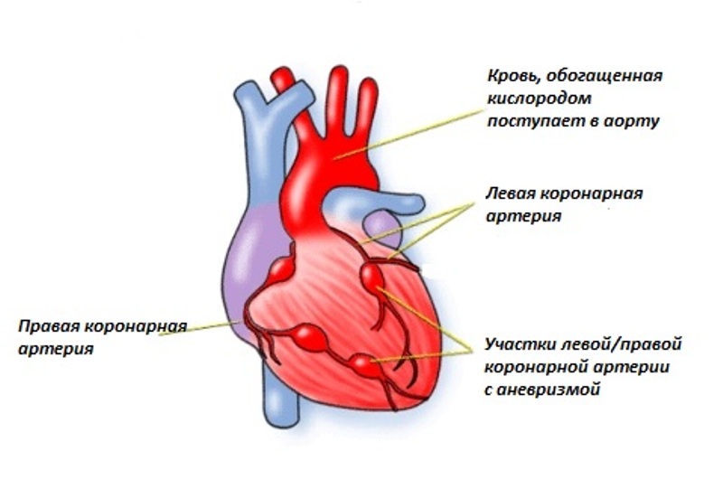 Расположение артерий