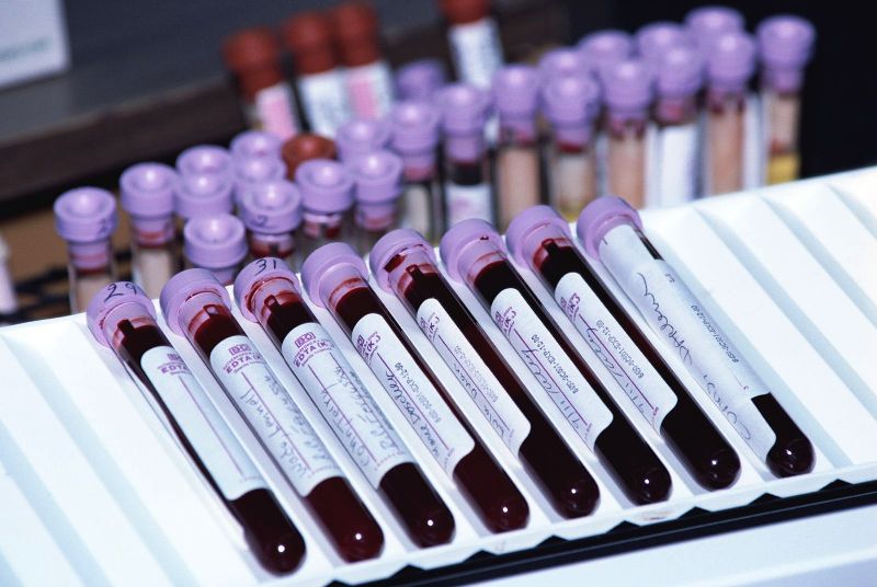 Серологический анализ крови